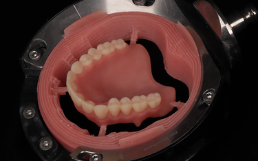 Digitale Prothese nach dem Ivotion Konzept | vom CAD-Design…